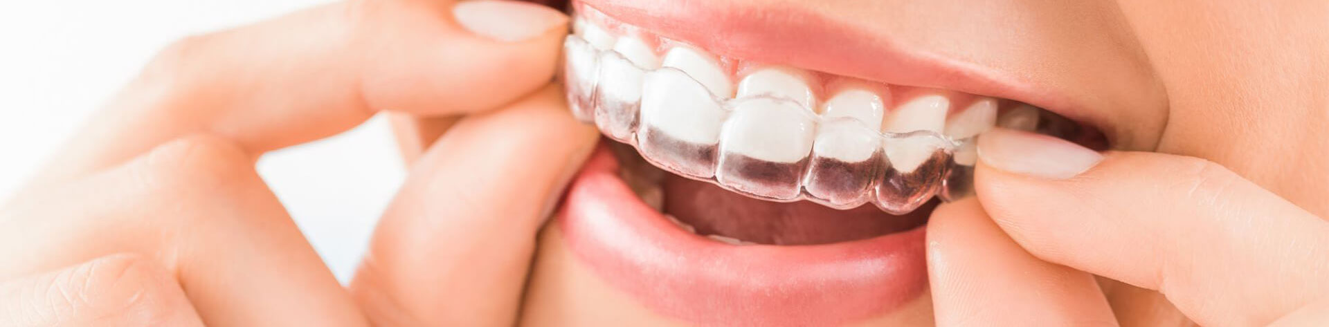 Clinica Mari Carmen perez clinica dental Badajoz, extremadura