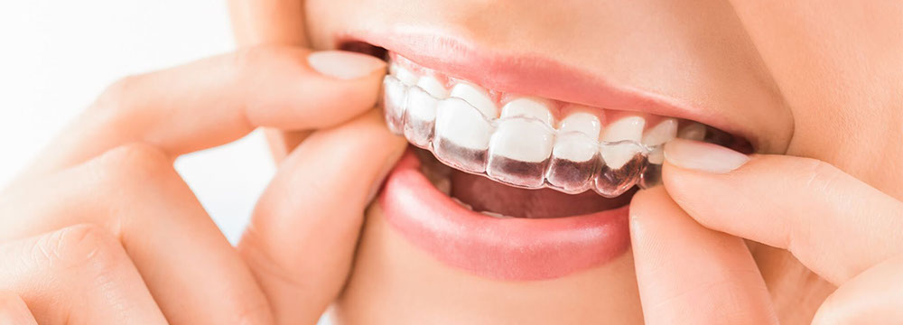 Clinica Mari Carmen perez clinica dental Badajoz, extremadura