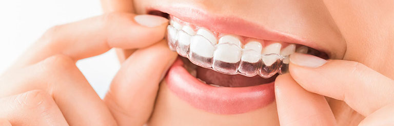 Clinica Mari Carmen perez clinica dental Badajoz, extremadura