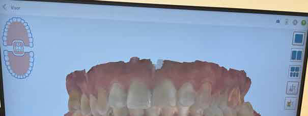 Clinica odontologia Mari Carmen perez clinica dental Badajoz, extremadura