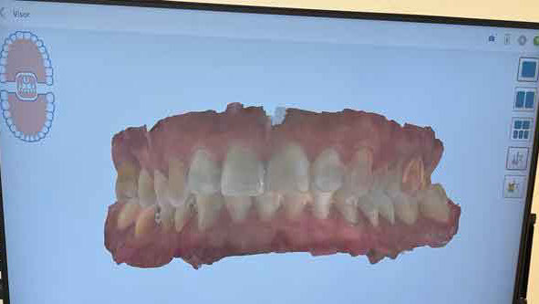 Clinica odontologia Mari Carmen perez clinica dental Badajoz, extremadura