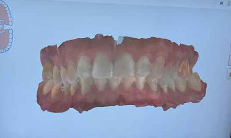 Clinica odontologia Mari Carmen perez clinica dental Badajoz, extremadura
