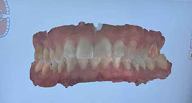 Clinica odontologia Mari Carmen perez clinica dental Badajoz, extremadura